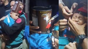 Viral Kaleng Biskuit Tersangkut di Kepala Bocah, Damkar Turun Tangan